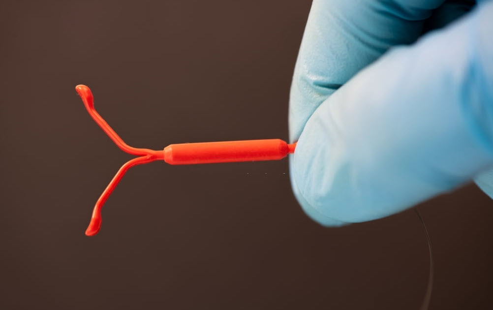 Cara Mencegah Kehamilan dengan IUD contraception